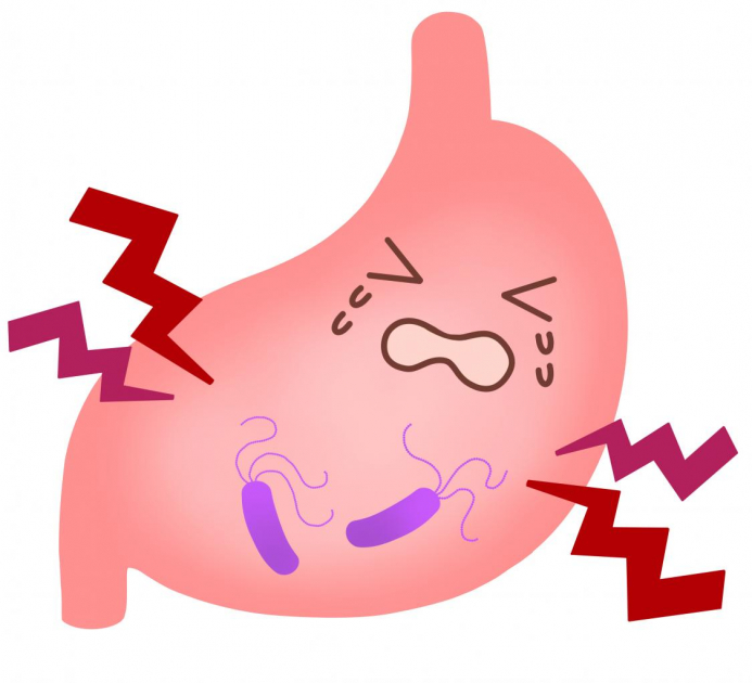 胃がんリスク検査（ABC分類） | 社会医療法人 明和会